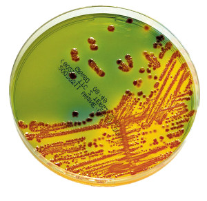 e-coli